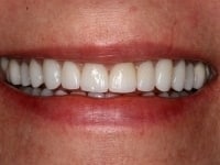 Konig Center for Cosmetic & Comprehensive Dentistry smile photos
